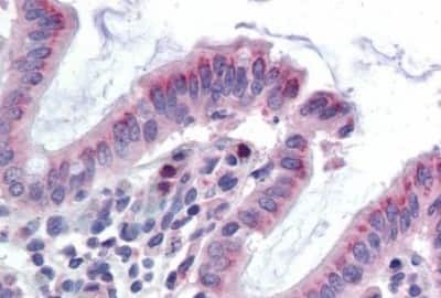 Immunohistochemistry-Paraffin: GCNT3 Antibody [NBP3-14331] - Immunohistochemistry of formalin-fixed, paraffin-embedded human colon after heat-induced antigen retrieval.